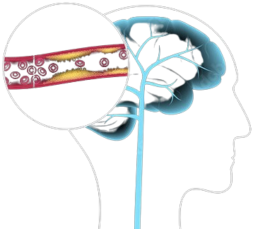 Brain_C-13_Benefits